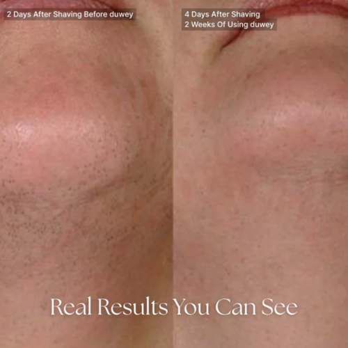 ItsNoure Cyperus Rotundus Oil