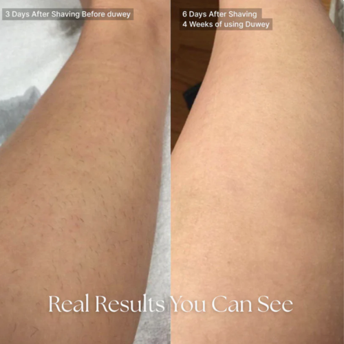 ItsNoure Cyperus Rotundus Oil